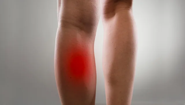 Understanding Calf Muscle Injuries and Rehabilitation