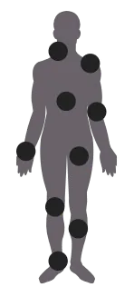 Human body diagram